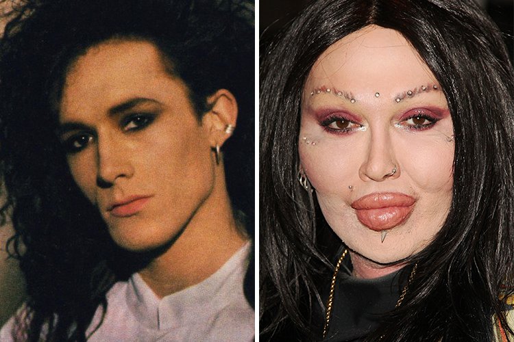  Cosmetic Surgery